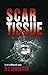Scar Tissue