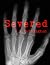 Severed by John A. Cuddington