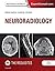 Neuroradiology by Rohini Nadgir MD