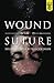 Wound and Suture