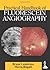 Practical Handbook of Fluorescein Angiography