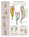 Low Back Pain e-c...