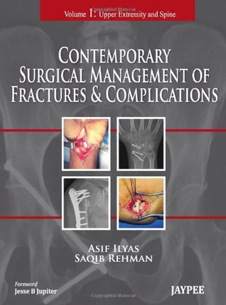Contemporary Surgical Management of Fractures and Complications (Hardcover)