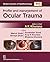 Profile and Management of Ocular Trauma (Modern System of Opthalmology)