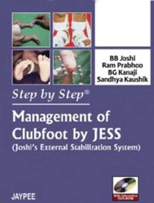 Management of Clubfoot by Jess: Joshi's External Stabilization System (Step by Step)