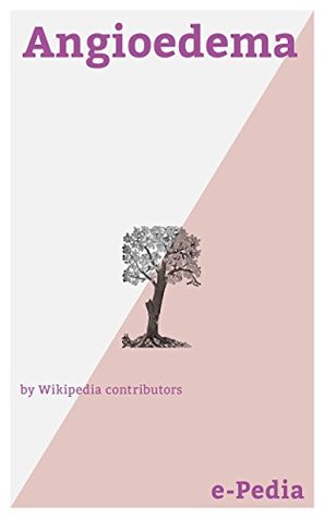 e-Pedia: Angioedema: Angioedema, also known as angiooedema, Quincke's edema, and angioneurotic edema, is the rapid swelling (edema) of the dermis, subcutaneous tissue, mucosa and submucosal tissues