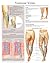 Varicose Veins e-chart: Full illustrated