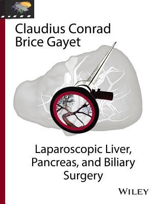 pdf download Laparoscopic Liver, Pancreas, and Biliary Surgery, Textbook and Illustrated Video Atlas