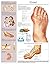 Gout e-chart: Full illustrated