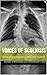 Voices of Scoliosis: Stories of our Experiences Managing Scoliosis