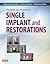 Principles and Practice of Single Implant and Restorations