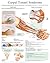 Carpal Tunnel Syndrome e chart: Full illustrated