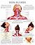 Neck injuries - Quick Reference Chart: Full illustrated
