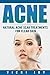 ACNE: Natural Acne Scar Tre...