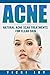 ACNE by Vicki Joy