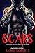 Scars