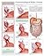 Gastroesophageal reflux disease e-chart: Full illustrated