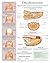 Onychomycosis e chart: Full...