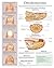 Onychomycosis e chart: Full illustrated