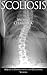 Scoliosis: A Guide to Under...
