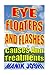 Eye Floaters and Flashes: Causes and Treatments