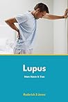 Lupus: Men Have It Too