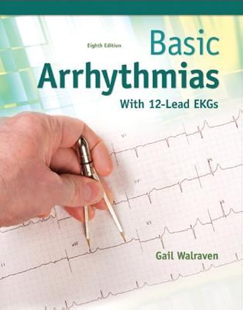Basic Arrhythmias