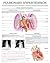 Pulmonary hypertension e chart: Full illustrated