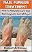 Nail Fungus Treatment: How ...