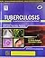 Tuberculosis: A Comprehensi...