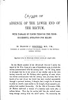 A Case of Absence of the Lower End of the Rectum by Francis J. Shepherd