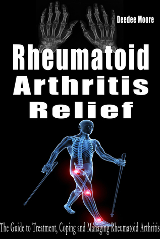 Rheumatoid Arthritis Relief: The Guide to Treatment, Coping and Managing Rheumatoid Arthritis