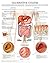 Ulcerative colitis e chart: Full illustrated