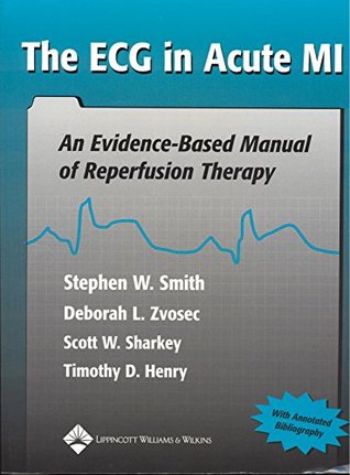 The ECG in Acute MI: An Evidence-Based Manual of Reperfusion Therapy (Kindle Edition)