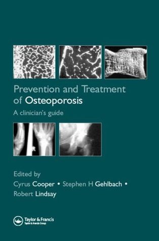 Prevention and Treatment of Osteoporosis: A Clinician’s Guide