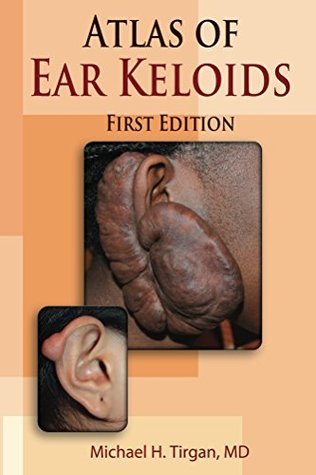 Atlas of Ear Keloids (Paperback)