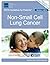 Non-Small Cell Lung Cancer