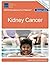 Kidney Cancer