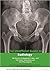 The Unofficial Guide to Radiology: 100 Practice Orthopaedic X Rays with Full Colour Annotations and Full X Ray Reports