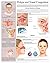 Polyps and Nasal Congestion e-chart: Full illustrated