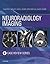 Neuroradiology Imaging Case Review E-Book