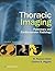 Thoracic Imaging: Pulmonary and Cardiovascular Radiology