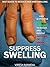 Suppress Swelling: Effective Home Remedies to reduce and prevent swelling