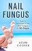 Nail Fungus Treatment by Adam Cooper