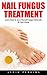 Nail Fungus Treatment: Learn How To Cure Toenail Fungus Naturally At Your Home! (How To Cure Toenail Fungus, Natural Remedies, Alternative Medicine)