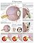 Glaucoma e chart: Full illustrated