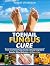 Toenail Fungus Cure: How to...