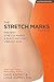The Stretch Marks Factor by Dave Asprey