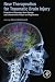 New Therapeutics for Traumatic Brain Injury by Kim Heidenreich New Therapeutics for Traumatic Brain Injury by Kim Heidenreich