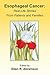 Esophageal Cancer by Ellen R. Abramson